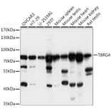 Western Blot - Anti-TBRG4 Antibody (A91267) - Antibodies.com