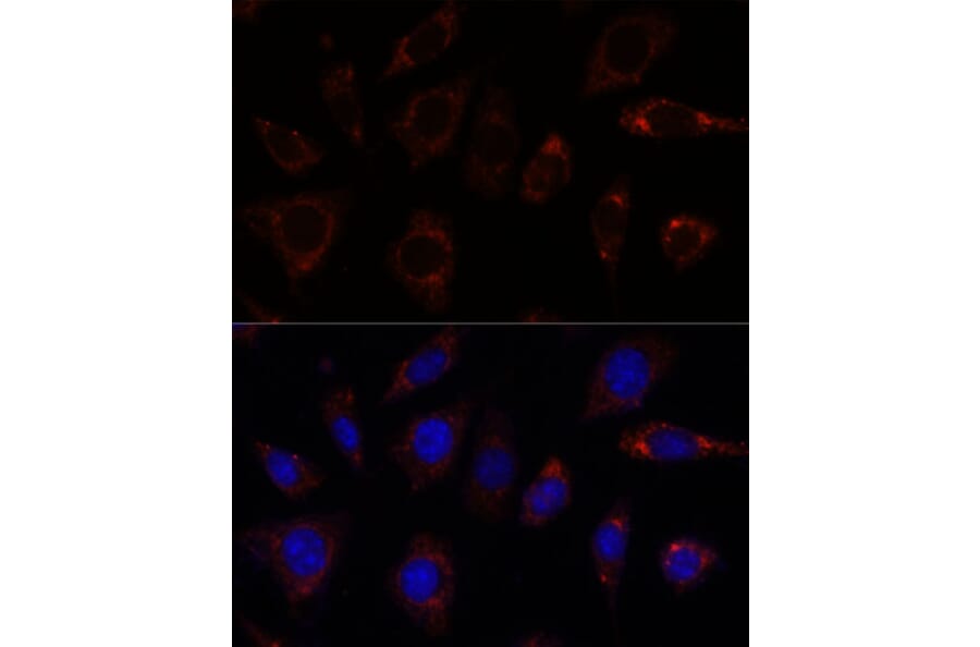 Immunofluorescence - Anti-TBRG4 Antibody (A91267) - Antibodies.com