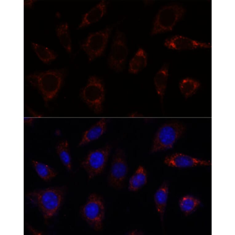 Immunofluorescence - Anti-TBRG4 Antibody (A91267) - Antibodies.com