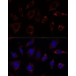 Immunofluorescence - Anti-TBRG4 Antibody (A91267) - Antibodies.com