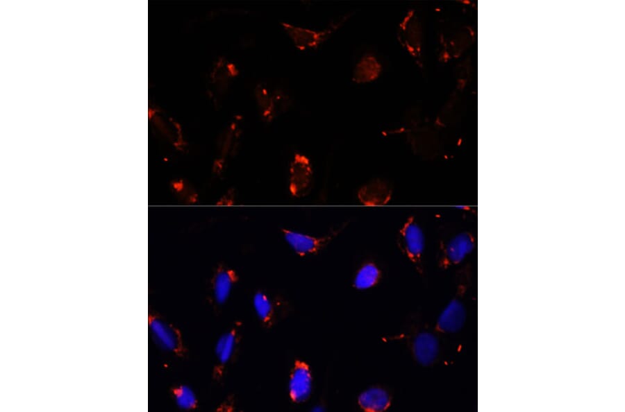 Immunofluorescence - Anti-TBRG4 Antibody (A91267) - Antibodies.com