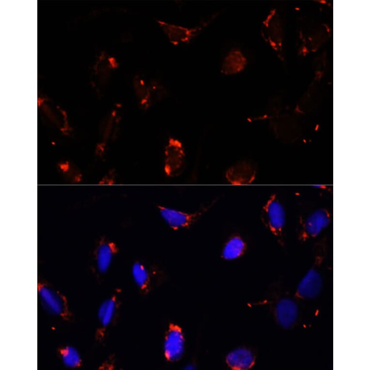 Immunofluorescence - Anti-TBRG4 Antibody (A91267) - Antibodies.com