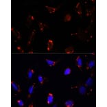 Immunofluorescence - Anti-TBRG4 Antibody (A91267) - Antibodies.com