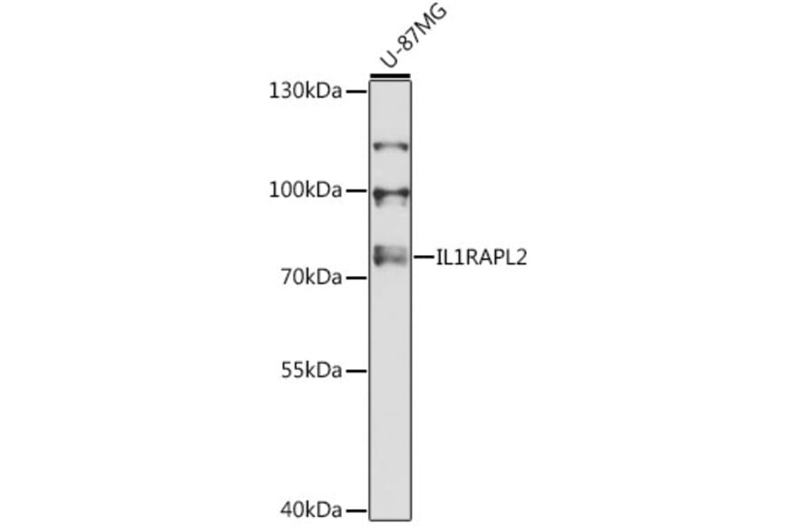 Western Blot - Anti-IL1RAPL2 Antibody (A13084) - Antibodies.com