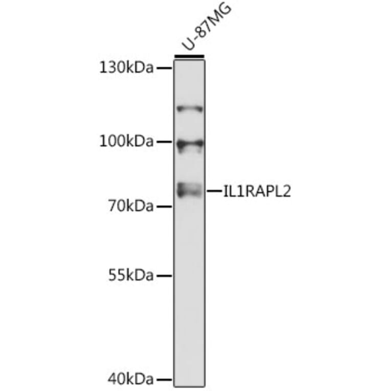 Western Blot - Anti-IL1RAPL2 Antibody (A13084) - Antibodies.com