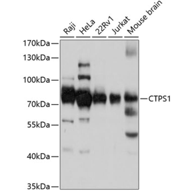 Western Blot - Anti-CTP synthase/CTPS Antibody (A91269) - Antibodies.com