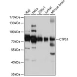 Western Blot - Anti-CTP synthase/CTPS Antibody (A91269) - Antibodies.com