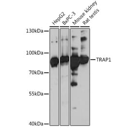 Western Blot - Anti-TRAP1 Antibody (A91270) - Antibodies.com