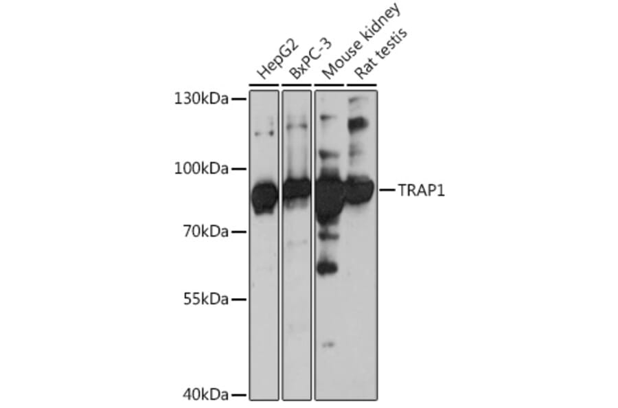 Western Blot - Anti-TRAP1 Antibody (A91270) - Antibodies.com