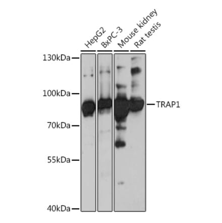 Western Blot - Anti-TRAP1 Antibody (A91270) - Antibodies.com