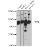 Western Blot - Anti-TRAP1 Antibody (A91270) - Antibodies.com