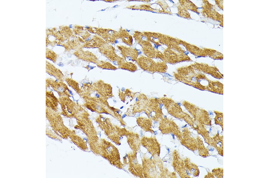 Immunohistochemistry - Anti-TRAP1 Antibody (A91270) - Antibodies.com