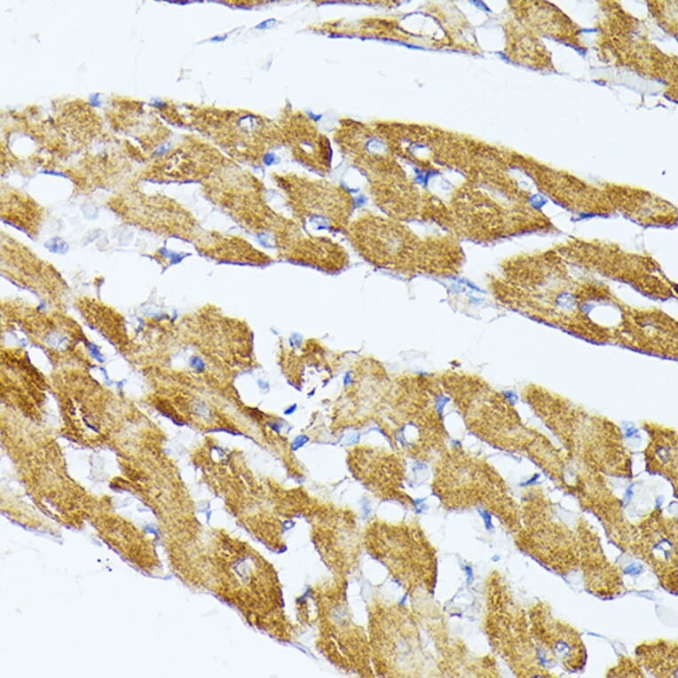 Immunohistochemistry - Anti-TRAP1 Antibody (A91270) - Antibodies.com