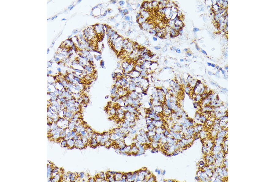 Immunohistochemistry - Anti-TRAP1 Antibody (A91270) - Antibodies.com