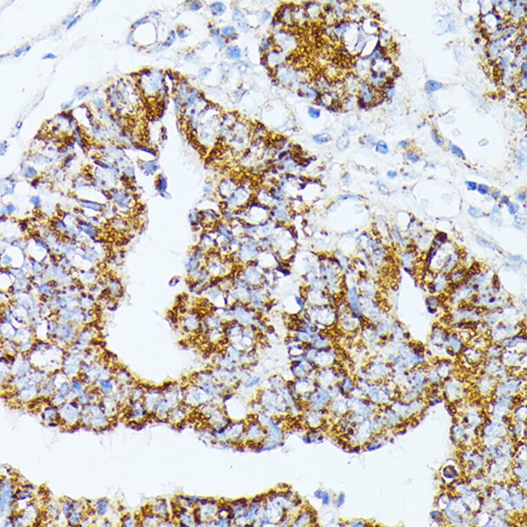 Immunohistochemistry - Anti-TRAP1 Antibody (A91270) - Antibodies.com