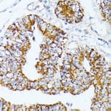 Immunohistochemistry - Anti-TRAP1 Antibody (A91270) - Antibodies.com