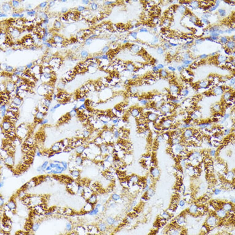 Immunohistochemistry - Anti-TRAP1 Antibody (A91270) - Antibodies.com