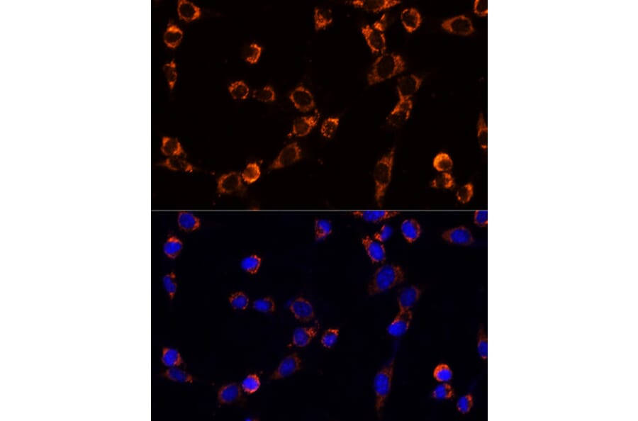 Immunofluorescence - Anti-TRAP1 Antibody (A91270) - Antibodies.com