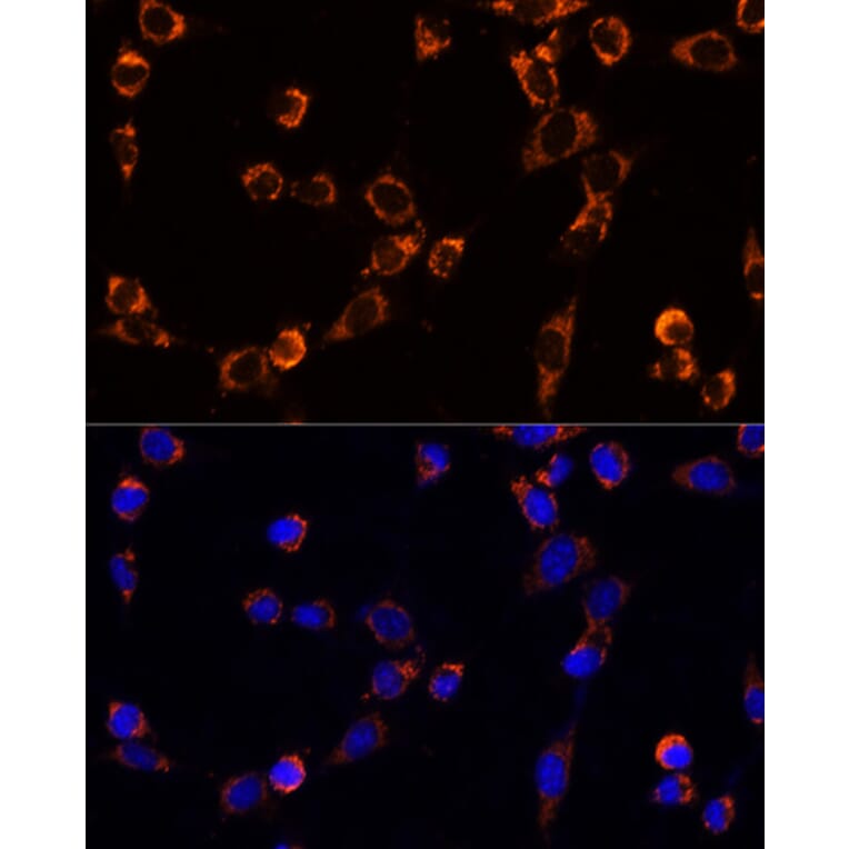 Immunofluorescence - Anti-TRAP1 Antibody (A91270) - Antibodies.com