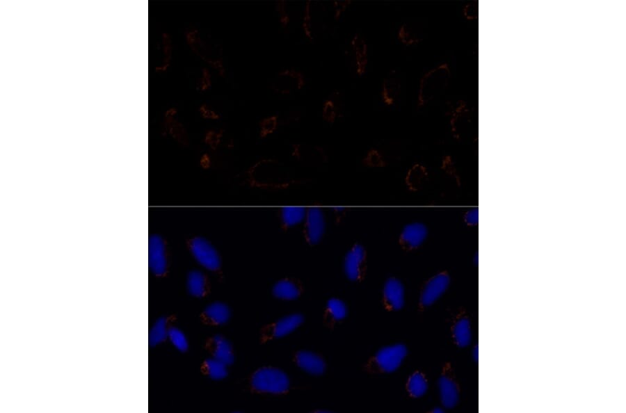 Immunofluorescence - Anti-TRAP1 Antibody (A91270) - Antibodies.com