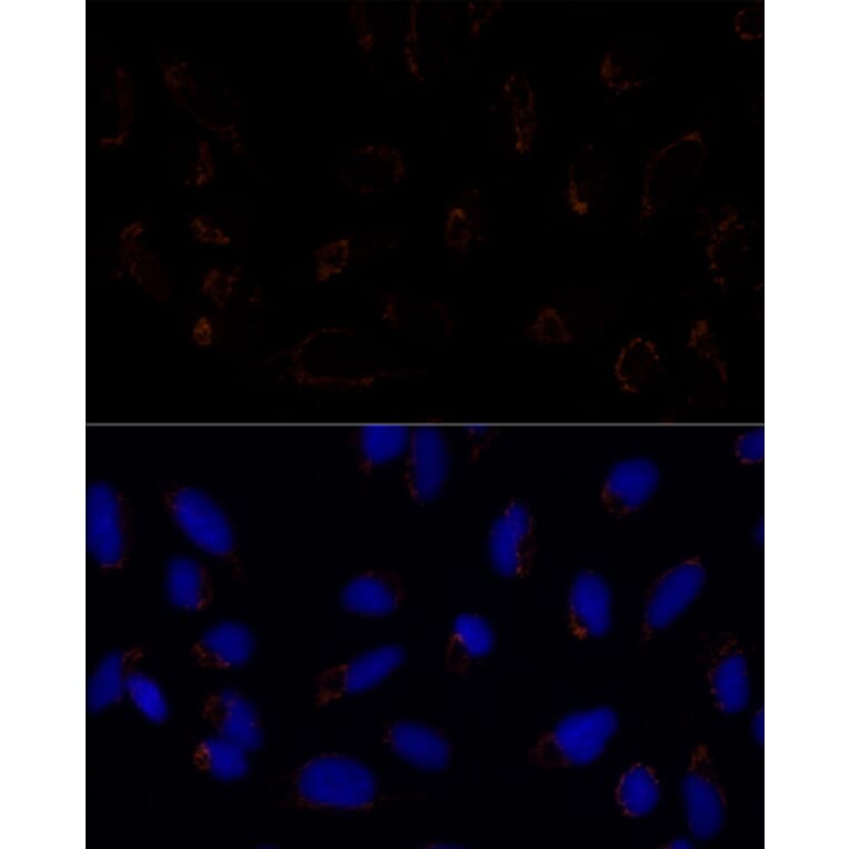 Immunofluorescence - Anti-TRAP1 Antibody (A91270) - Antibodies.com