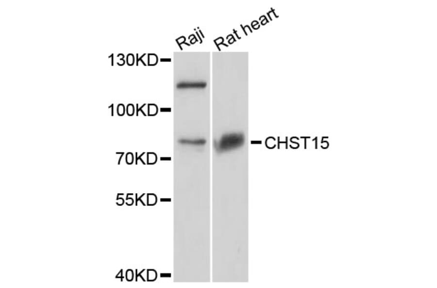 Western Blot - Anti-CHST15 Antibody (A8984) - Antibodies.com