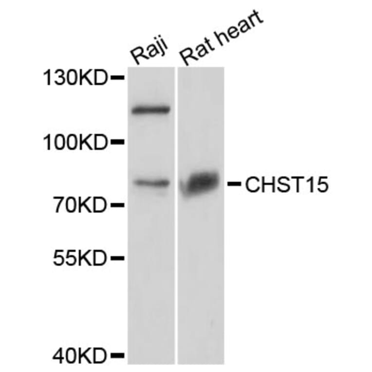 Western Blot - Anti-CHST15 Antibody (A8984) - Antibodies.com