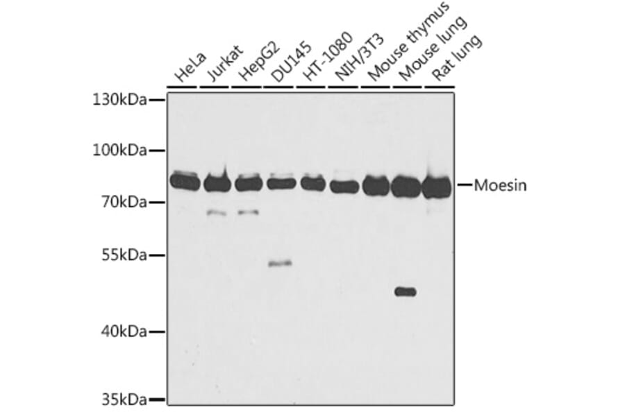 Western Blot - Anti-Moesin Antibody (A91272) - Antibodies.com