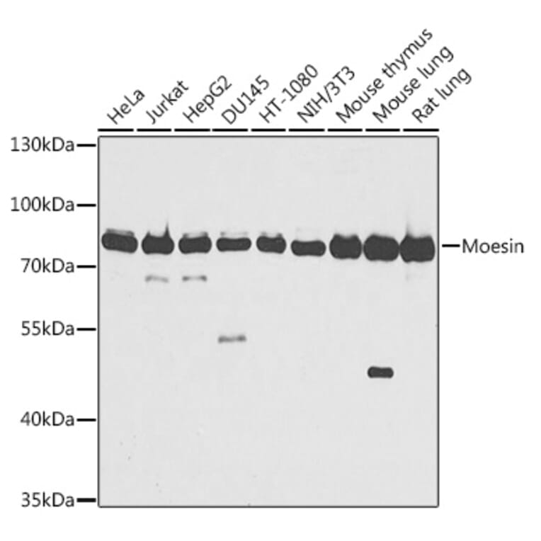 Western Blot - Anti-Moesin Antibody (A91272) - Antibodies.com