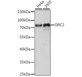 Western Blot - Anti-ORC2 Antibody (A91273) - Antibodies.com