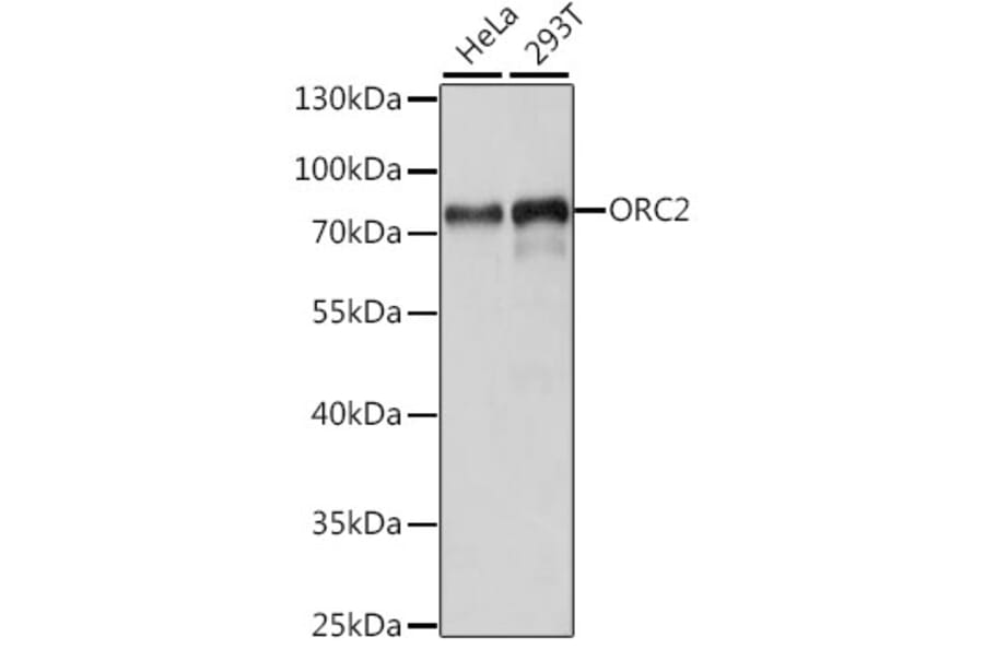 Western Blot - Anti-ORC2 Antibody (A91273) - Antibodies.com