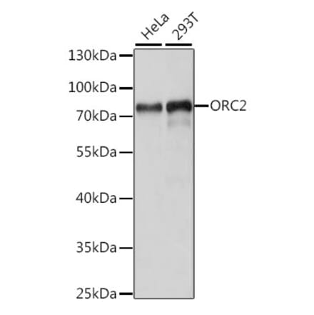 Western Blot - Anti-ORC2 Antibody (A91273) - Antibodies.com