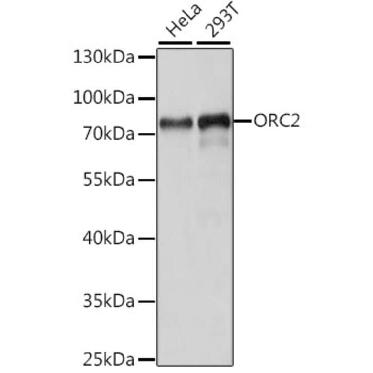 Western Blot - Anti-ORC2 Antibody (A91273) - Antibodies.com