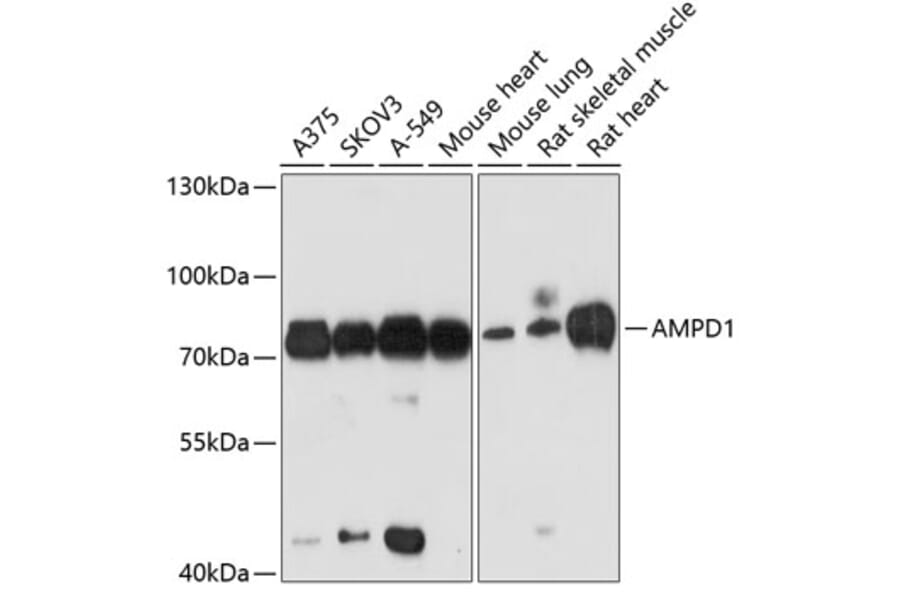 Western Blot - Anti-AMPD1 Antibody (A91275) - Antibodies.com