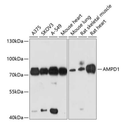 Western Blot - Anti-AMPD1 Antibody (A91275) - Antibodies.com