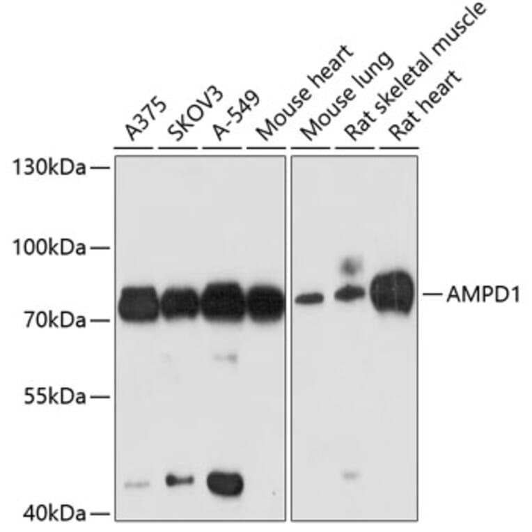 Western Blot - Anti-AMPD1 Antibody (A91275) - Antibodies.com