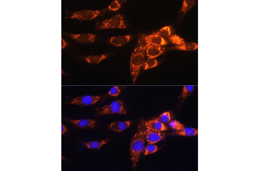 Immunofluorescence - Anti-AMPD1 Antibody (A91275) - Antibodies.com
