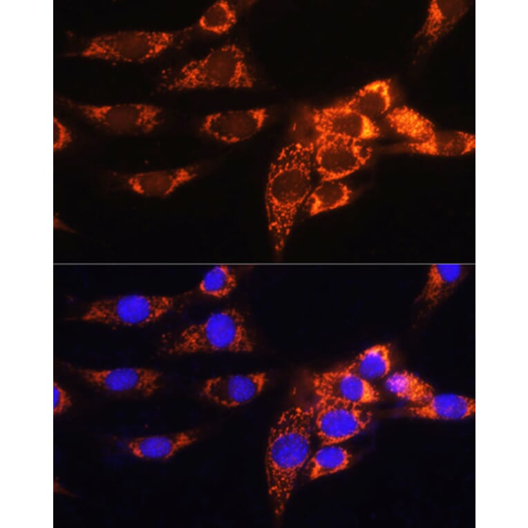 Immunofluorescence - Anti-AMPD1 Antibody (A91275) - Antibodies.com