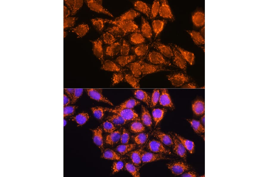 Immunofluorescence - Anti-AMPD1 Antibody (A91275) - Antibodies.com