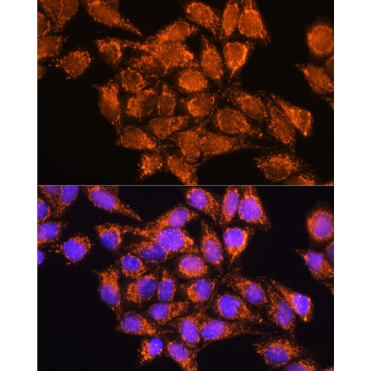 Immunofluorescence - Anti-AMPD1 Antibody (A91275) - Antibodies.com