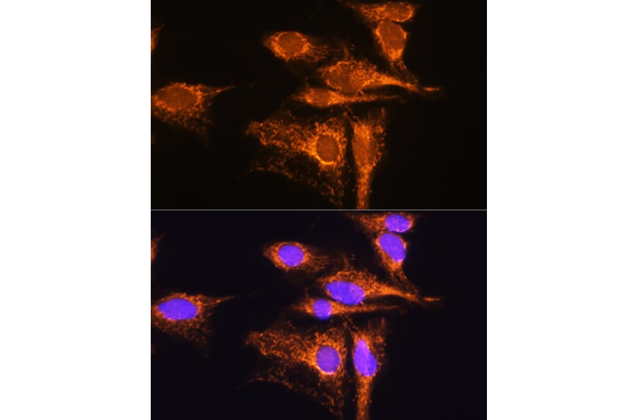 Immunofluorescence - Anti-AMPD1 Antibody (A91275) - Antibodies.com