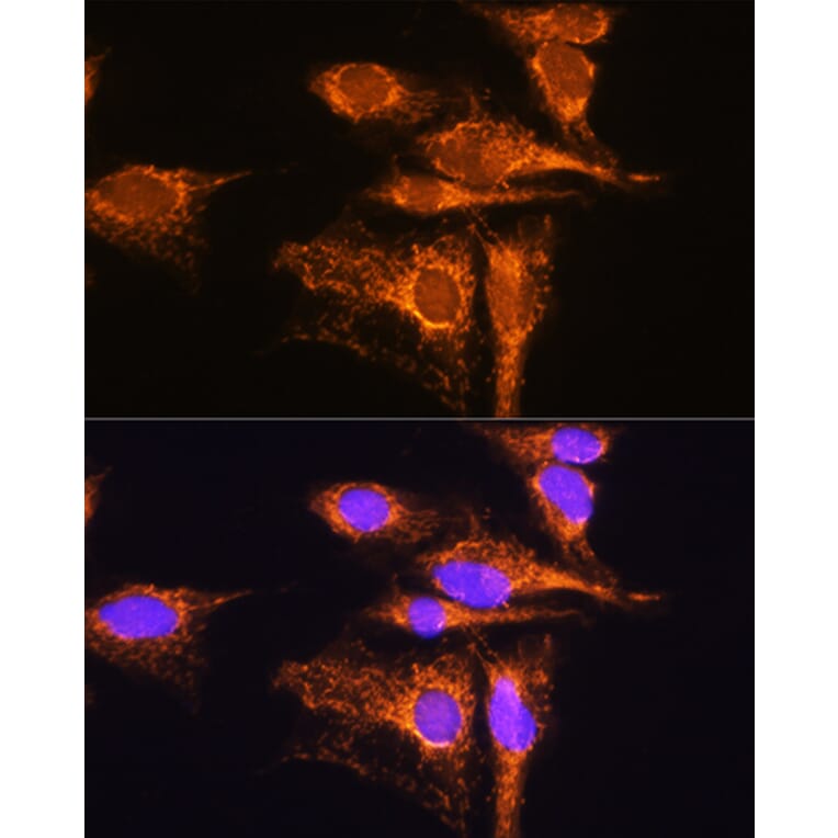 Immunofluorescence - Anti-AMPD1 Antibody (A91275) - Antibodies.com