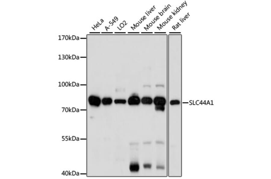 Western Blot - Anti-SLC44A1/CTL1 Antibody (A91276) - Antibodies.com