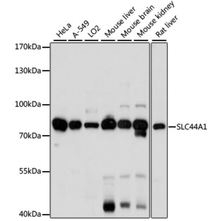Western Blot - Anti-SLC44A1/CTL1 Antibody (A91276) - Antibodies.com