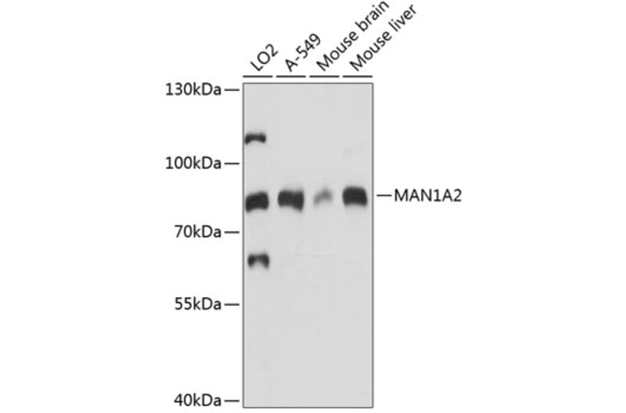 Western Blot - Anti-MAN1A2 Antibody (A91277) - Antibodies.com