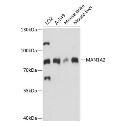 Western Blot - Anti-MAN1A2 Antibody (A91277) - Antibodies.com