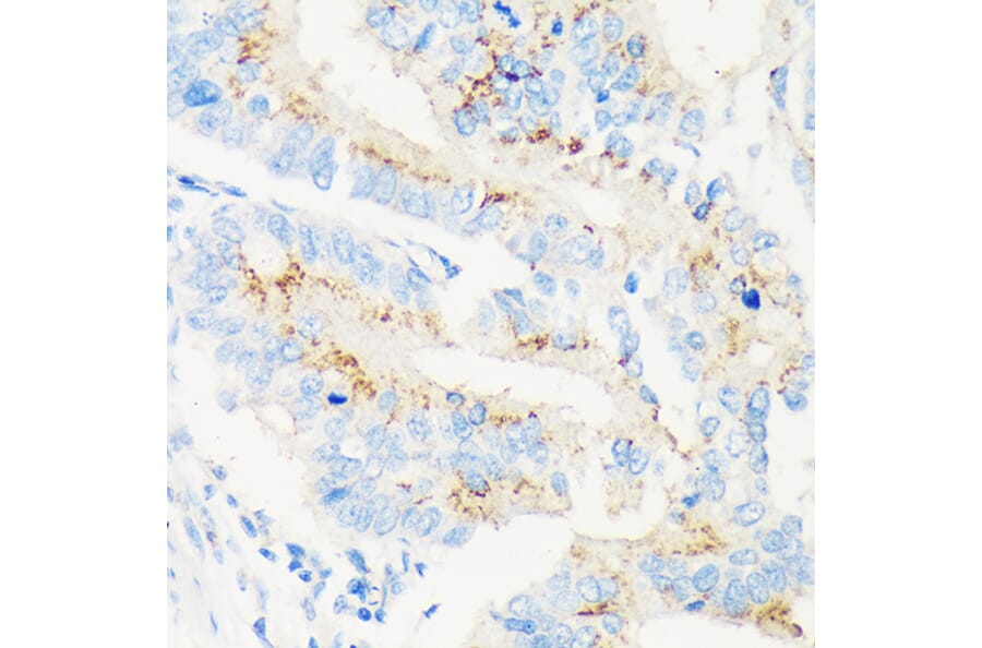 Immunohistochemistry - Anti-MAN1A2 Antibody (A91277) - Antibodies.com