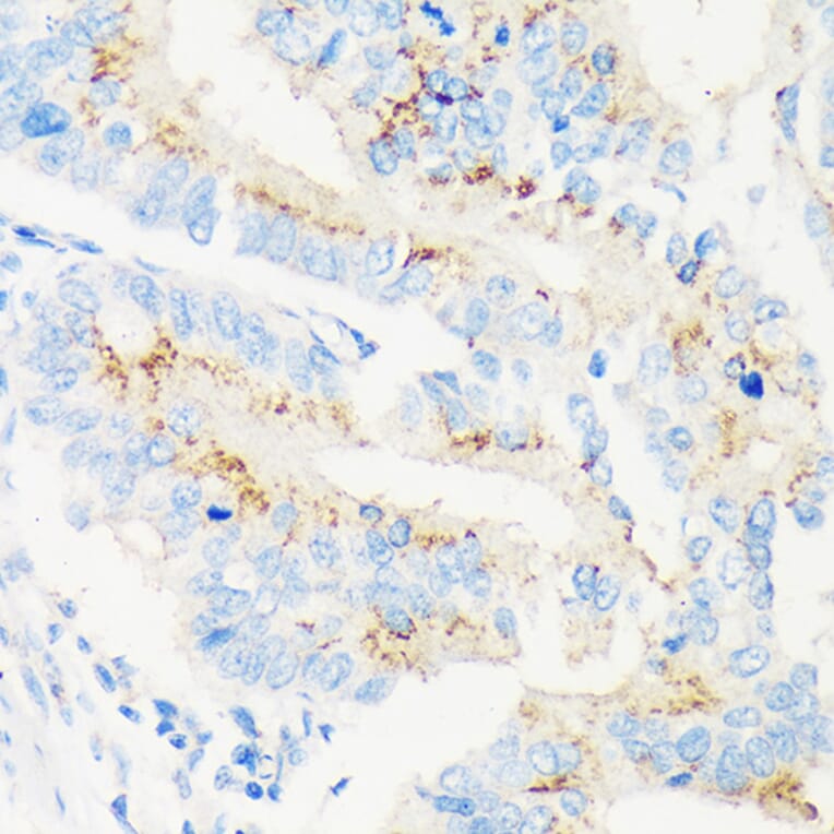 Immunohistochemistry - Anti-MAN1A2 Antibody (A91277) - Antibodies.com