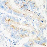 Immunohistochemistry - Anti-MAN1A2 Antibody (A91277) - Antibodies.com