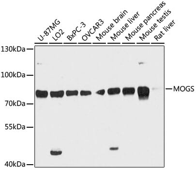 Western blot analysis of extracts of various cell lines, using Anti-MOGS Antibody (A12725) at 1:3000 dilution.
Secondary antibody: Goat Anti-Rabbit IgG (H+L) (HRP) (AS014) at 1:10,000 dilution.
Lysates / proteins: 25µg per lane.
Blocking buffer: 3% non-fat dry milk in TBST.
Detection: ECL Basic Kit (RM00020).
Exposure time: 90s.